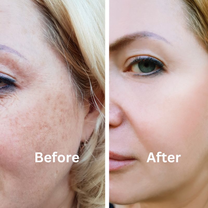 No More Pigmentation - Gluta One Booster Recovery Serum Bundle