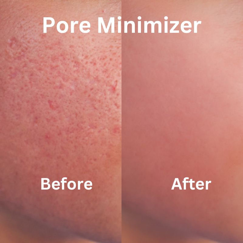 pore minimizer serum price in Paksitan